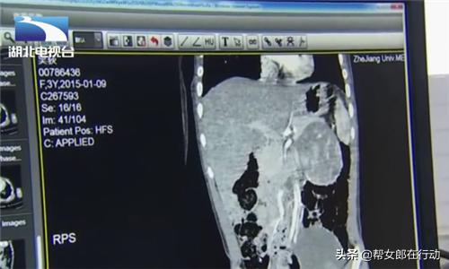 小男孩举止女性化,12岁孩子举止