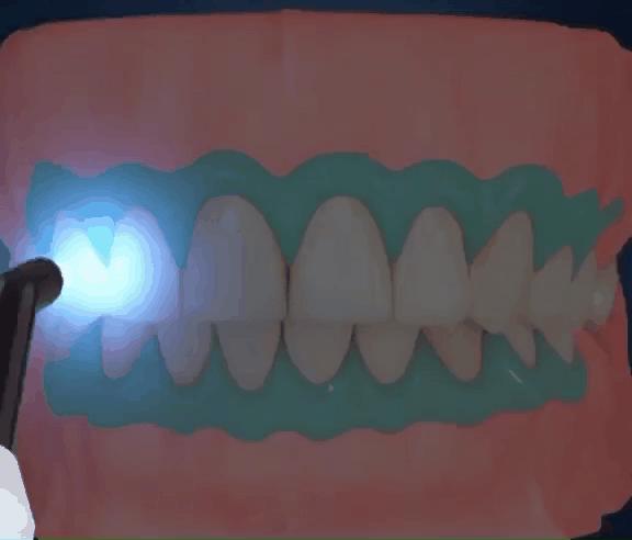 牙齿美白祛黄神器好评语,牙齿祛黄美白用什么产品比较好