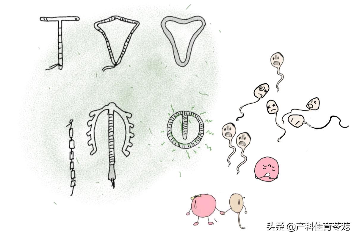 靠谱的避孕方法,疾病科普避孕方法之一