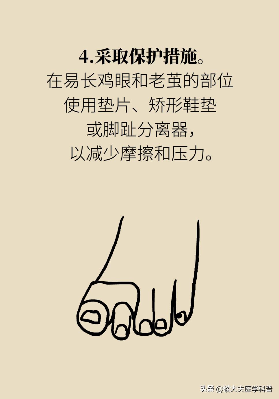 鸡眼好了长了一层老茧,鸡眼与老茧的区别图片