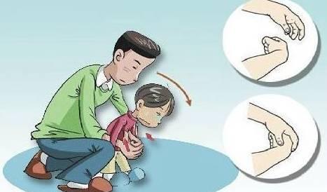 吃东西卡喉咙的施救方法,成人异物卡喉窒息的急救方法