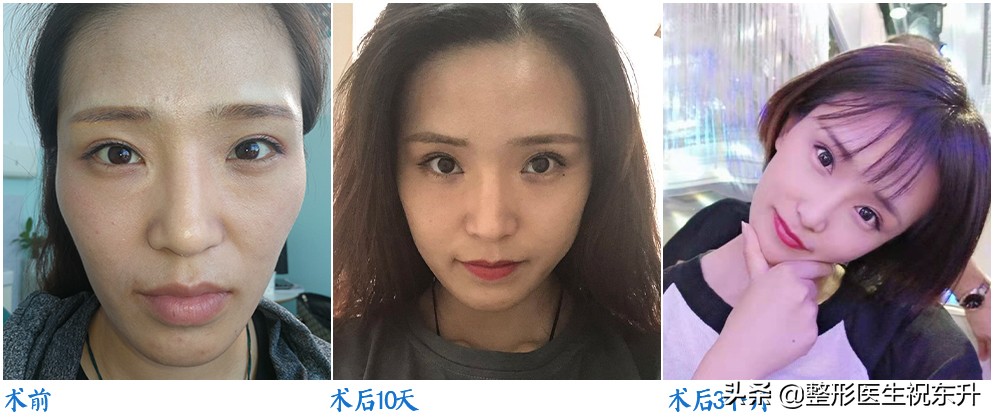 颧骨高有什么不好,颧骨高真的不好相处吗