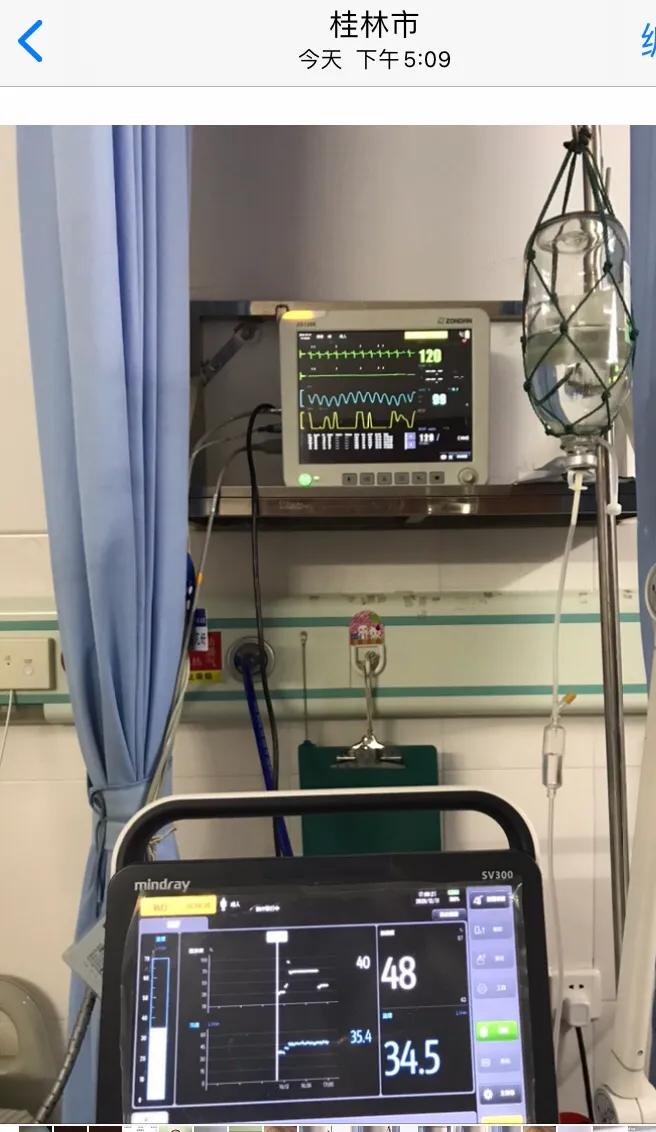 心室颤动患者的抢救首选,室上性心动过速急诊治疗