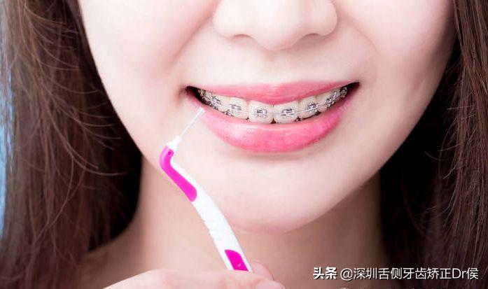 值得收藏的牙齿护理时间表,怎么护理牙齿才能用一辈子