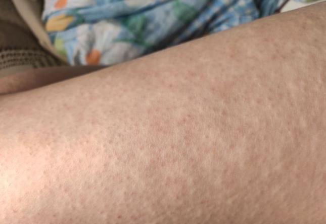 凡士林身体乳蓝盖和粉盖的区别,凡士林美白身体乳蓝盖和粉盖区别