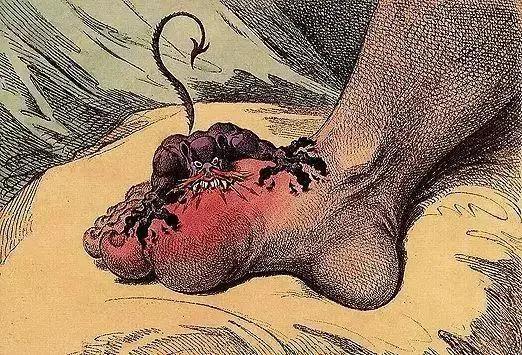 老公痛风老婆怎么办,老公重病老婆起诉离婚怎么办