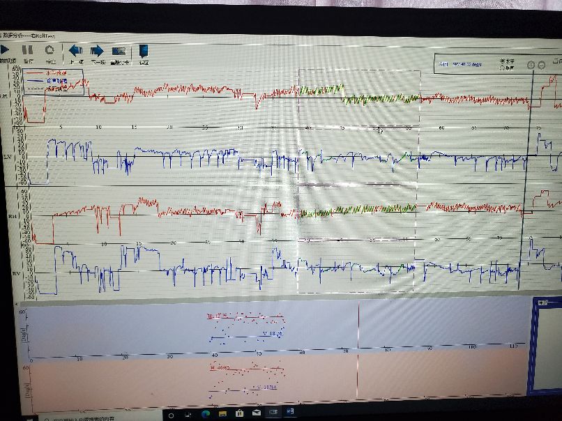 老年人颈椎病引起头晕恶心呕吐,头晕恶心干呕是不是颈椎病