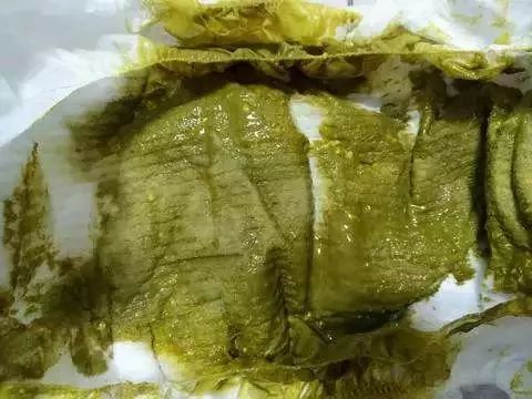 婴儿拉绿便的几种形状,宝宝拉绿便怎么鉴别