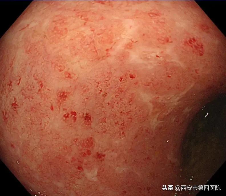 健康中国2023重大行动,健康中国行动是真是假