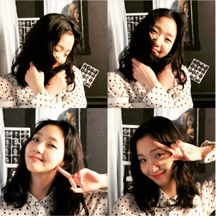 单眼皮怎么整容变双眼皮,嫌弃自己双眼皮小怎么办