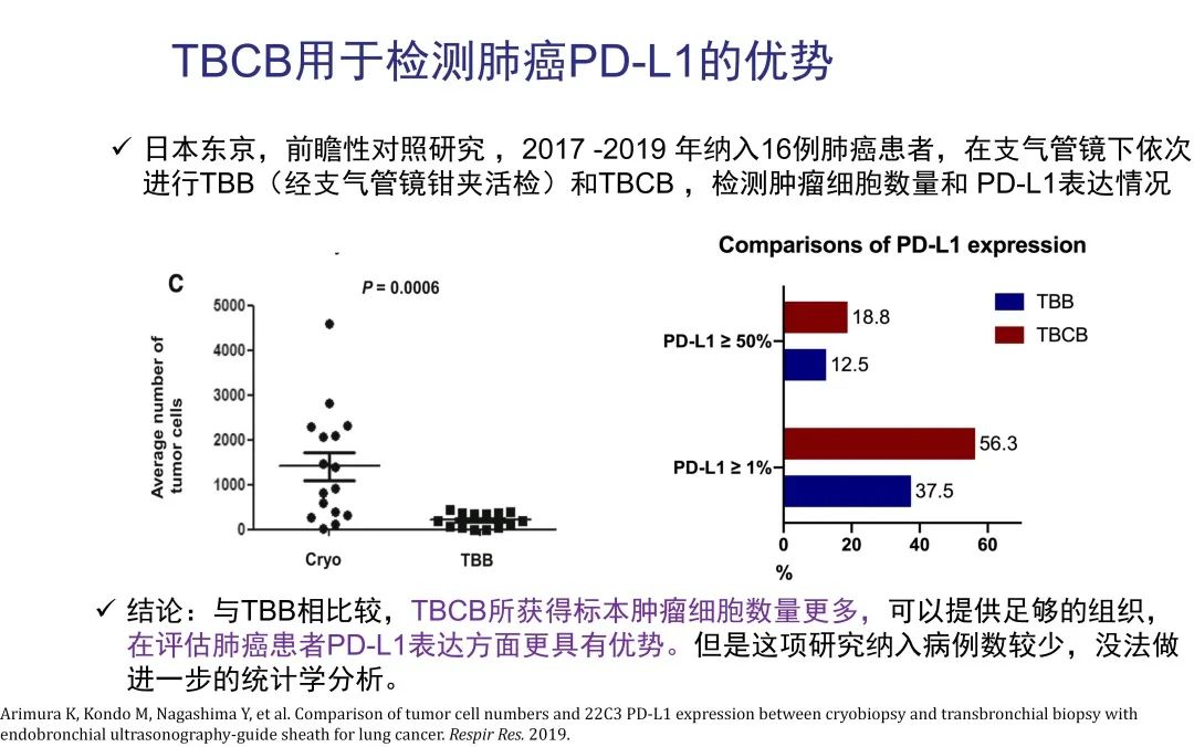 经皮肺穿刺活检术过程,经支气管冷冻肺活检