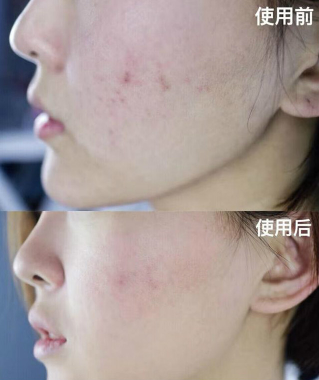 欧阳娜娜和周冬雨是什么关系,28岁的周冬雨图片