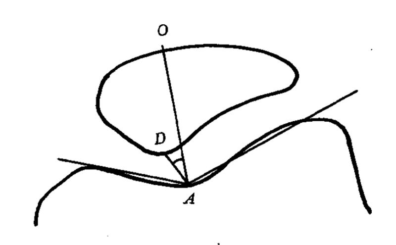 膝关节x线片可以查出啥,膝关节间隙x线测量方法