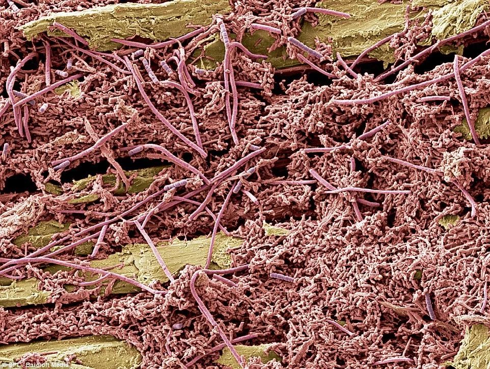 孩子嘴里味道很怪,儿童嘴里有消化不良的味道