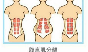 产后盆底恢复训练方法,盆底功能恢复训练视频