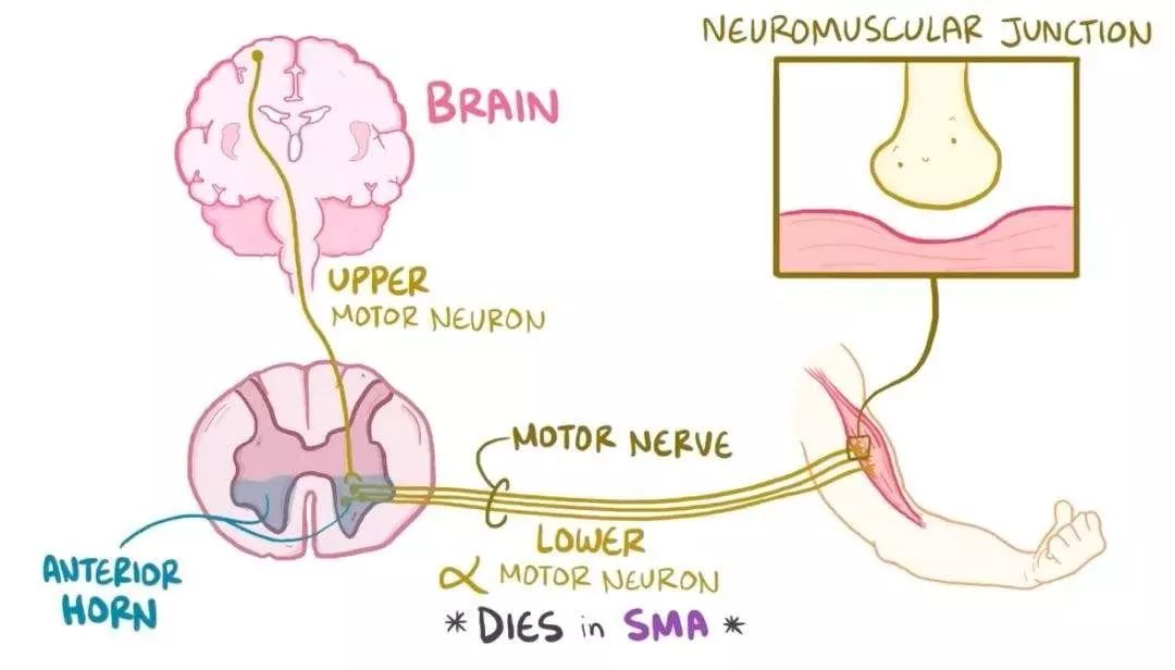 一针1469万世界上最贵的药,史上最贵的救命药物
