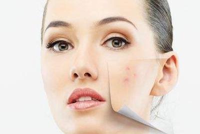 怎样祛痘印方法最有效,怎样祛痘印小妙招视频