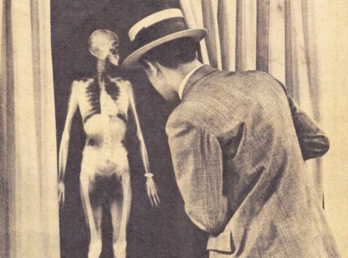 对x线辐射不敏感,x射线的发现和研究历史是怎样的