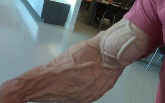 身上看到青筋什么原因,小腿能看见青筋正常吗