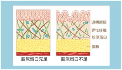 法令纹都是有什么方法可以去除,去法令纹最有效的办法明星