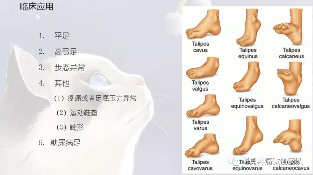 下肢不舒服查什么科,下肢不舒服做什么检查