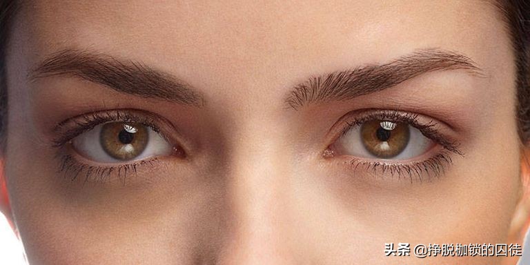 女孩黑眼圈重什么原因造成的,中医认为黑眼圈是什么原因造成的