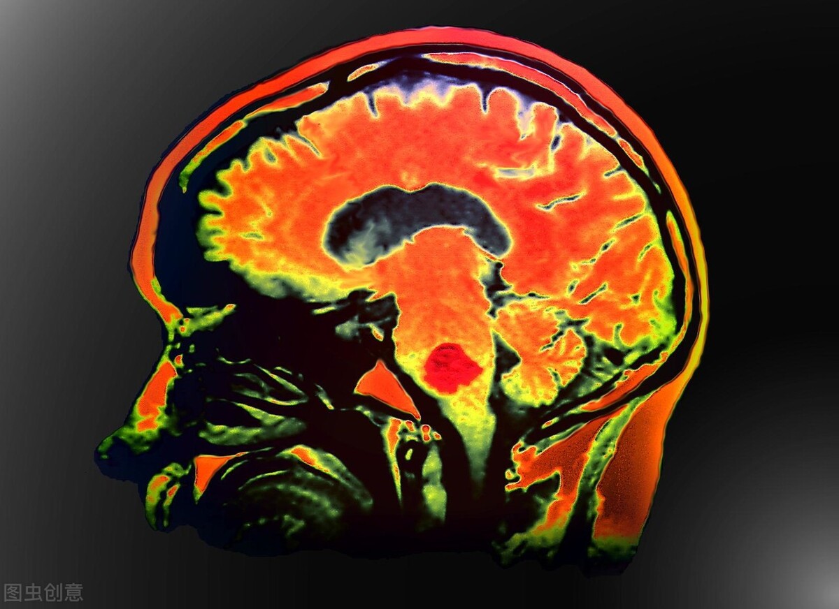 脑肿瘤化疗后长期起不来什么原因,癌症化疗导致脑梗怎么办