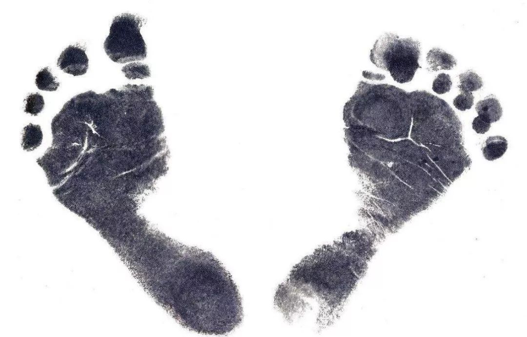 适用于所有腿型的腿型矫正方法,怎样矫正腿型让腿变得又细又直