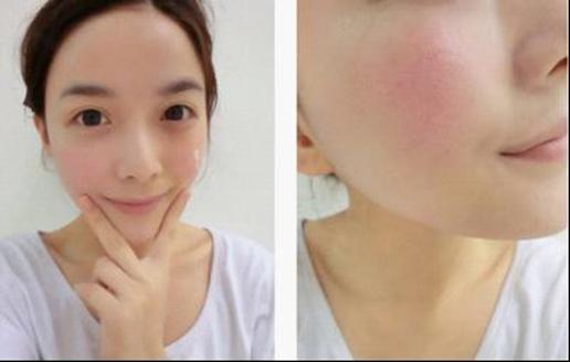 皮肤基础知识及各类皮肤护理重点,皮肤的基础医学知识及护理重点