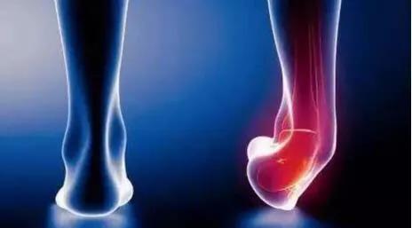 轻度崴脚未肿的正确处理办法,崴脚了可以自己修复