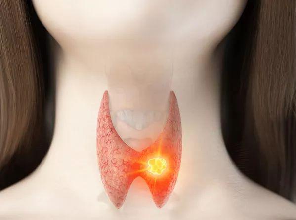 体检查出九种病不用治,华西医院十种病不用去治