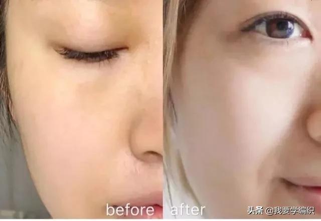 冬天脸干,连皱纹都出来了?日本女博士教你一招,抹几下白白嫩嫩