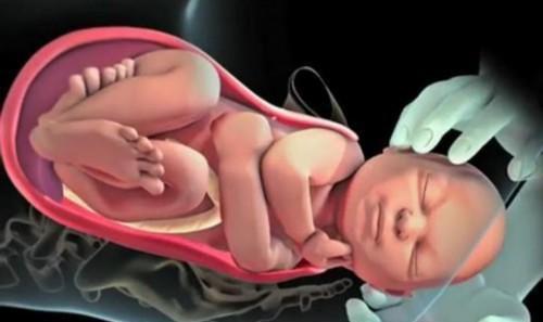 宫缩时产妇疼得死去活来,宫缩疼和胎儿撑得疼区别