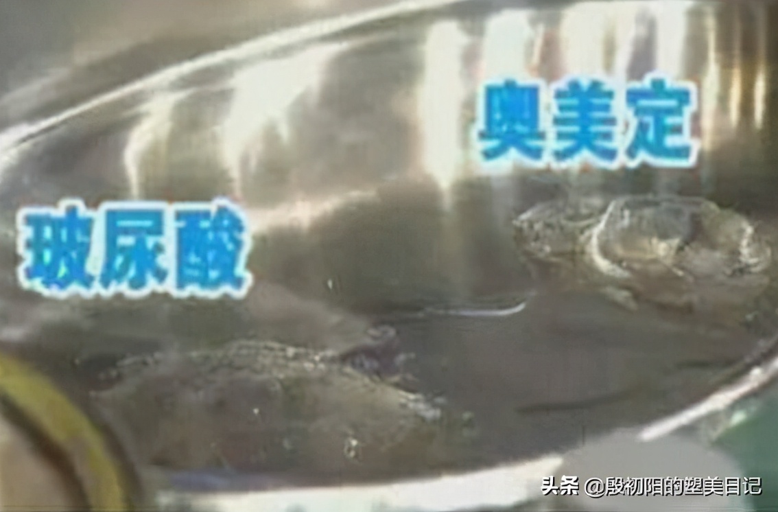 注射奥美定经历,奥美定注射多久会游走