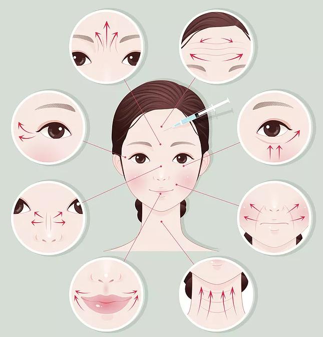 瘦脸针三针是否真的定型,瘦脸针是什么原理有副作用吗