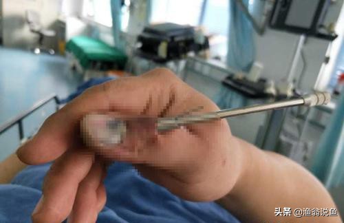 高效毒辣的“射鱼*党**”，诱人的鱼获下，却隐藏危机