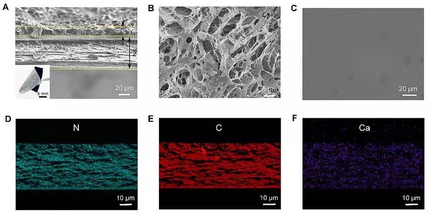 上海交大：用于引导骨再生的新型仿生多功能双层纳米复合膜材料