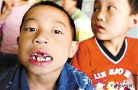 儿童铅中毒的危害有多可怕,儿童铅中毒案例