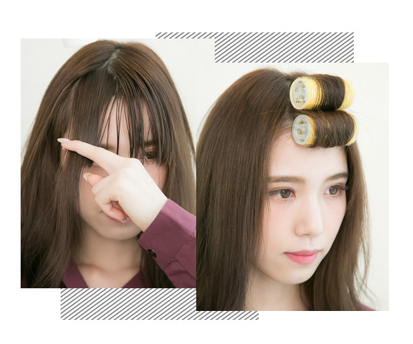 额头长痘怎么办才能快速消除,额头长痘了怎么快速消除