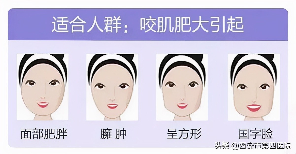 鎵撶槮鑴搁拡鎮勬倓鍙樼編,瀹夊績鍙樼編鐨勪汉閫傚悎鐦﹁劯閽堝悧