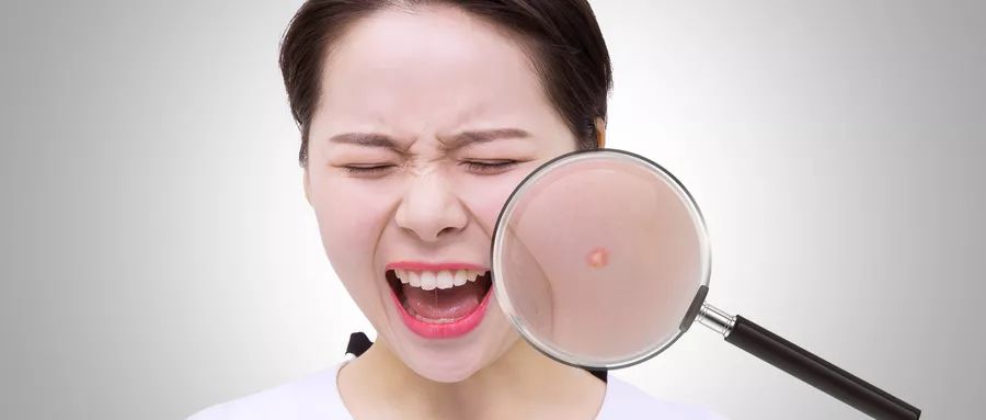 痘痘怎么防治小妙招,痘痘怎么治疗最快最有效