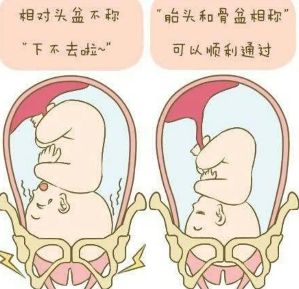 孕38周+3天，浅入盆第三天，分享宝宝入盆后自己的身体变化