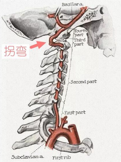 颈性眩晕每天发作,早起总犯晕怎么回事