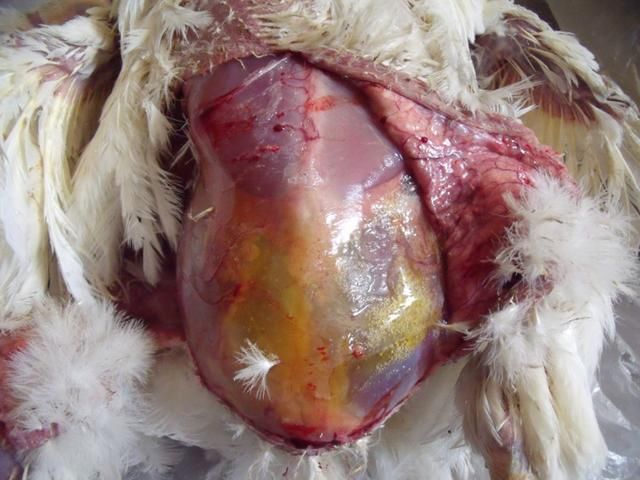 鹅肾肿治疗方法,鹅肾肿的原因