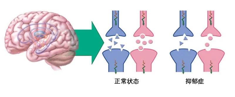 胃不好医生开了抗焦虑药物,肠胃病为什么要开抗抑郁药