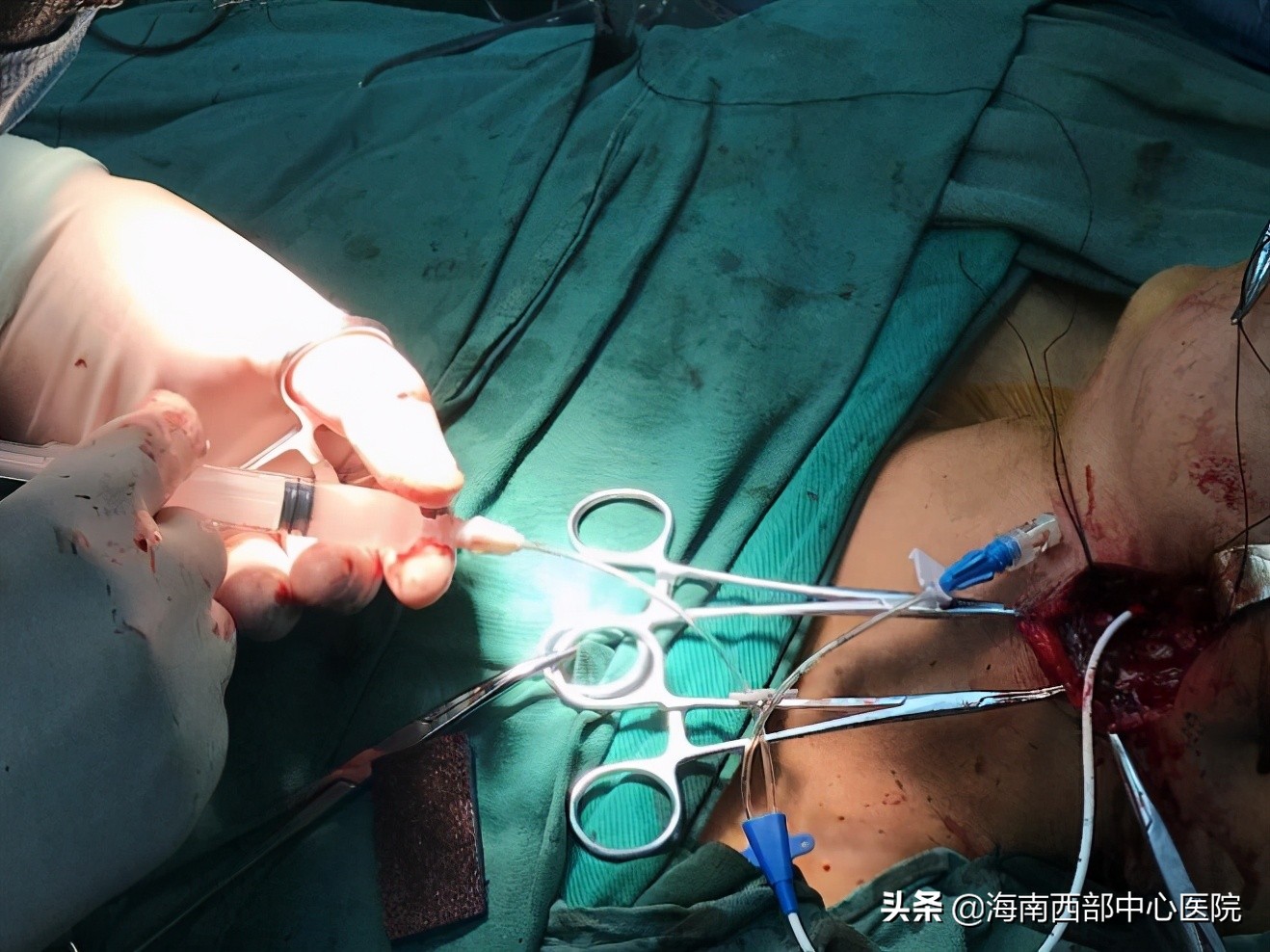 海南西部中心医院进展,海南西部中心医院三期进展