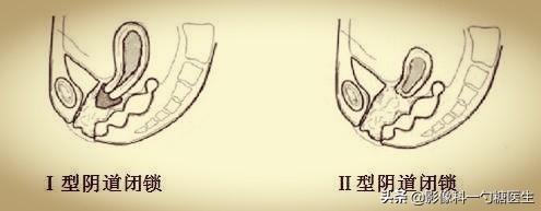 从14岁到17岁,从14岁到22岁