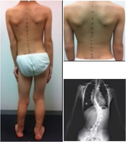 合脚的鞋子才是适合自己的,合脚的鞋才是最好的鞋