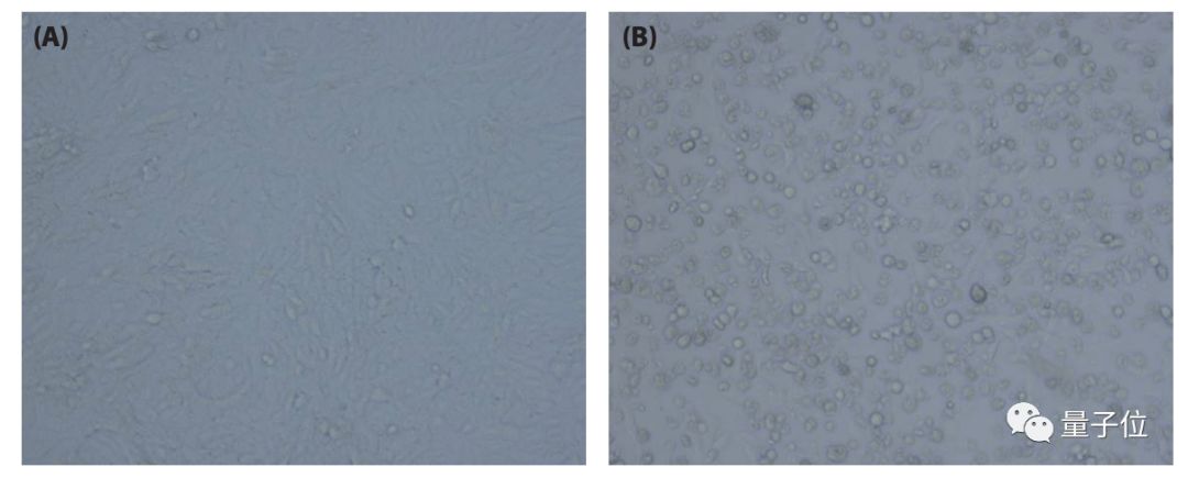 管轶等人最新证据：*私走**的穿山甲携带冠状病毒，与新冠病毒高度相似