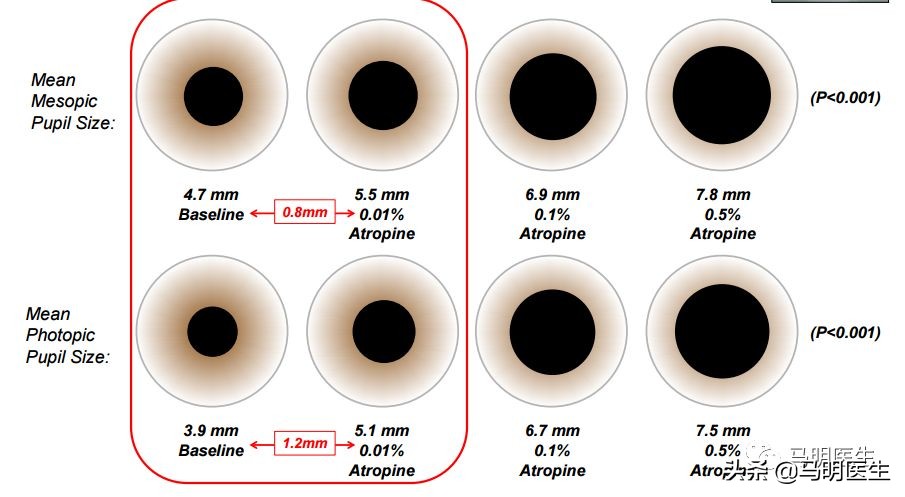 近视防控阿托品用对了吗,预防和治疗近视的阿托品